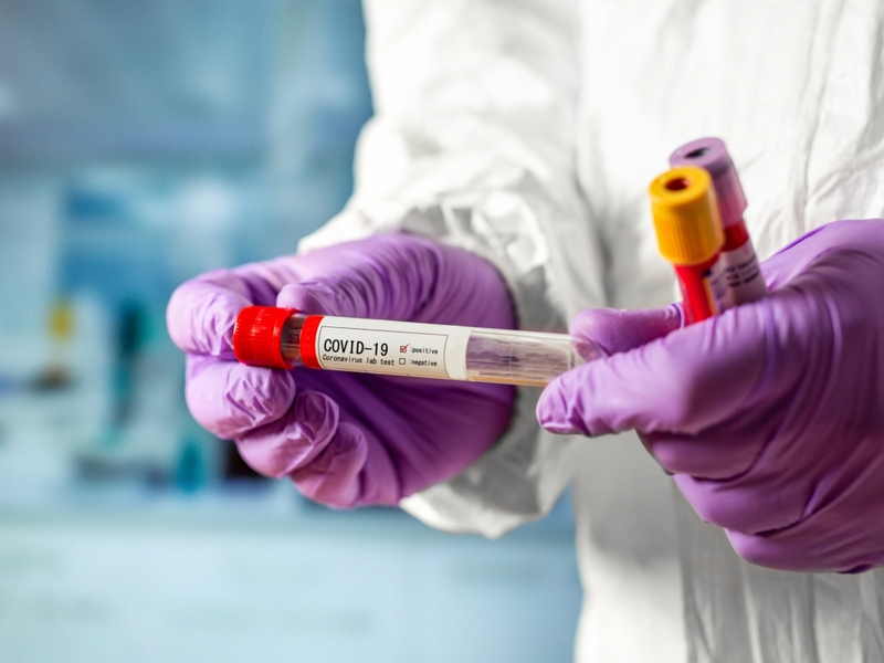 В Липецкой области подтверждено 34 новых случая коронавируса